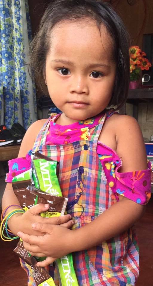 Mariel graduates from malnutrition Mariel graduates from malnutrition